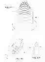 Fig. 20 - Joint arthroplasty devices and surgical tools