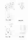 Fig. 35 - Joint arthroplasty devices and surgical tools
