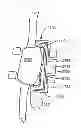 Fig. 01 - Joint arthroplasty devices and surgical tools