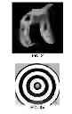 Fig. 03 - Joint arthroplasty devices and surgical tools