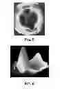 Fig. 05 - Joint arthroplasty devices and surgical tools