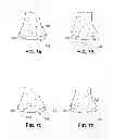 Fig. 06 - Joint arthroplasty devices and surgical tools