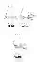 Fig. 13 - Joint arthroplasty devices and surgical tools