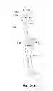 Fig. 23 - Joint arthroplasty devices and surgical tools