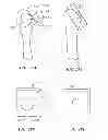 Fig. 35 - Joint arthroplasty devices and surgical tools