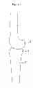Fig. 02 - Artificial knee joint and surgical instrument used in artificial knee joint replacement surgery