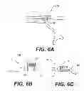 Fig. 07 - Thoracoscopic instrument