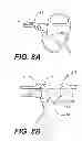 Fig. 09 - Thoracoscopic instrument