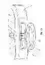 Fig. 06 - Articulating basket with simultaneous basket extension or basket retraction