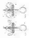Fig. 09 - Articulating basket with simultaneous basket extension or basket retraction