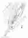 Fig. 04 - Apparatus for applying surgical clips