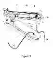 Fig. 04 - Micro sewing device