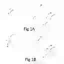 Fig. 02 - Variable depth surgical fixation