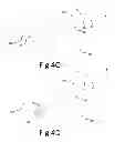 Fig. 09 - Variable depth surgical fixation
