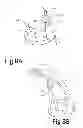 Fig. 16 - Variable depth surgical fixation