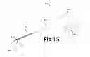 Fig. 20 - Variable depth surgical fixation