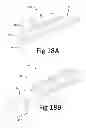 Fig. 22 - Variable depth surgical fixation