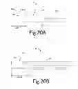 Fig. 24 - Variable depth surgical fixation