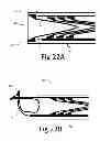 Fig. 26 - Variable depth surgical fixation