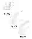 Fig. 32 - Variable depth surgical fixation