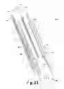 Fig. 34 - Variable depth surgical fixation