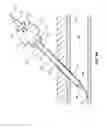 Fig. 08 - Collapsible sheath and tapered dilator for tissue puncture access
