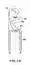 Fig. 16 - Removable embolus blood clot filter