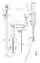 Fig. 02 - Balloon bailout and bioadhesive delivery device for suture based closure and methods