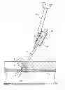 Fig. 01 - Bioadhesive mixing and delivery device and methods