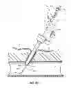Fig. 08 - Bioadhesive mixing and delivery device and methods