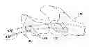 Fig. 01 - HIGH TENSION SUTURE ANCHOR