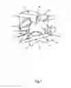 Fig. 02 - Spinal facet implants with mating articulating bearing surface and methods of use