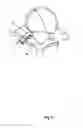 Fig. 07 - Spinal facet implants with mating articulating bearing surface and methods of use