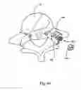 Fig. 44 - Spinal facet implants with mating articulating bearing surface and methods of use