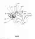 Fig. 49 - Spinal facet implants with mating articulating bearing surface and methods of use
