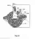 Fig. 63 - Spinal facet implants with mating articulating bearing surface and methods of use