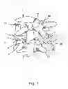 Fig. 02 - Linked bilateral spinal facet implants and methods of use