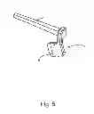 Fig. 06 - Linked bilateral spinal facet implants and methods of use