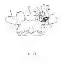 Fig. 22 - Linked bilateral spinal facet implants and methods of use