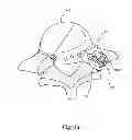 Fig. 44 - Linked bilateral spinal facet implants and methods of use