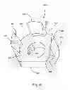 Fig. 46 - Linked bilateral spinal facet implants and methods of use