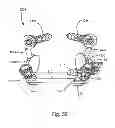 Fig. 69 - Linked bilateral spinal facet implants and methods of use