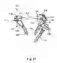 Fig. 71 - Linked bilateral spinal facet implants and methods of use