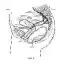 Fig. 02 - Devices and methods for stimulating nerves
