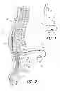 Fig. 02 - Method for programming implantable device
