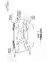 Fig. 02 - Synergistic muscle activation device