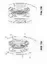 Fig. 03 - Synergistic muscle activation device