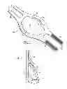 Fig. 02 - SECURABLE ICE PACK DEVICE