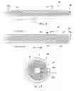 Fig. 06 - Systems and methods for improving RF compatibility of electrical stimulation leads