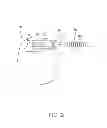 Fig. 03 - Electrical stimulation lead with junction and methods of making and using